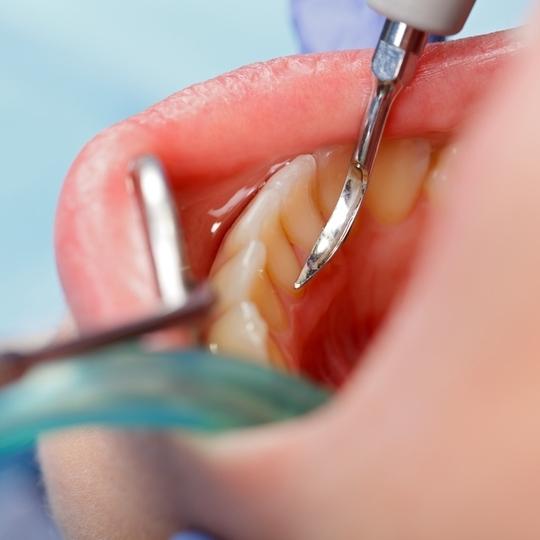 Periodontal Dentistry